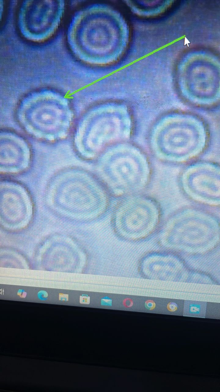 I FEEL UNWELL. I THINK I HAVE FEVER  